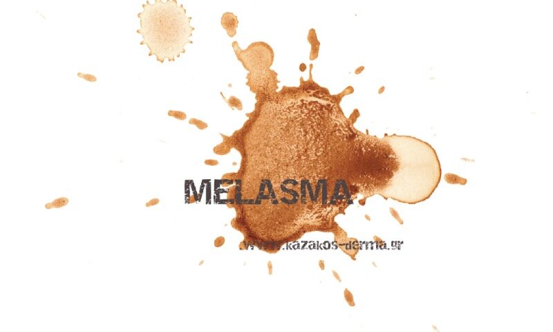 μέλασμα, παναδα, δερματολογία, kazakos dermatologist, kazakos dermatologos, καλοσ δερματολογοσ αθηνα, καζακοσ δερματολογοσ dermalab, καζακοσ δερματολογοσ, δερματολογοσ κολωνακι, δερματολογοσ συνταγμα, Δερματολογικο κεντρο κολωνακι, οι καλυτεροι δερματολογοι στην αθηνα, καζακος χαρης, δερματολογοσ μετροπολιταν,